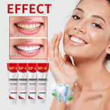 Yayashi SP6 Whitening Toothpaste 120gβ Removes Stains from Coffee, Tea & Smoking